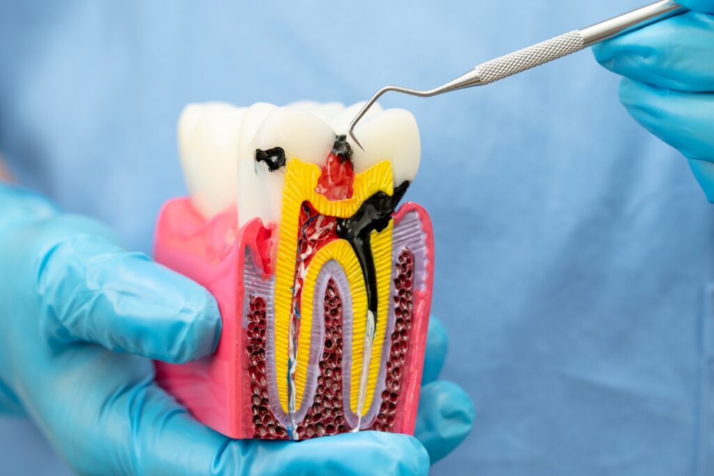 asian dentist holding dental implant artificial