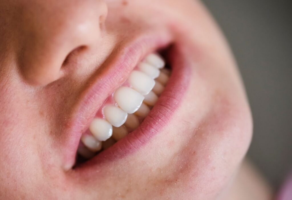 tooth close up